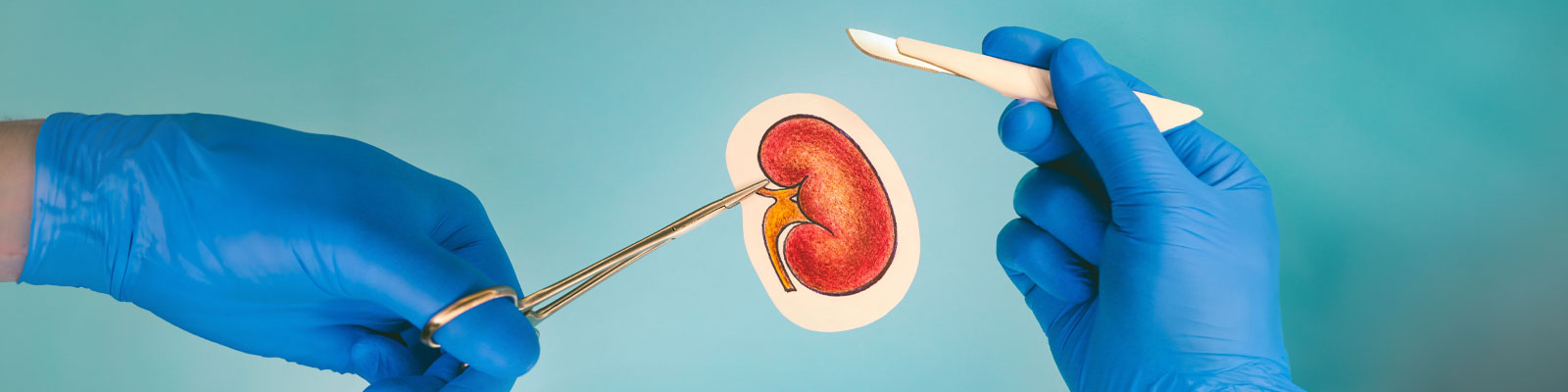 Preparing For Kidney Transplantation A Step-by-Step Guide For Patients In India