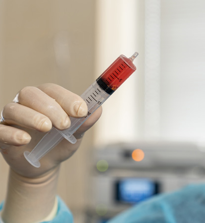 What to Expect and How to Prepare for Bone Marrow Transplant Treatment Options