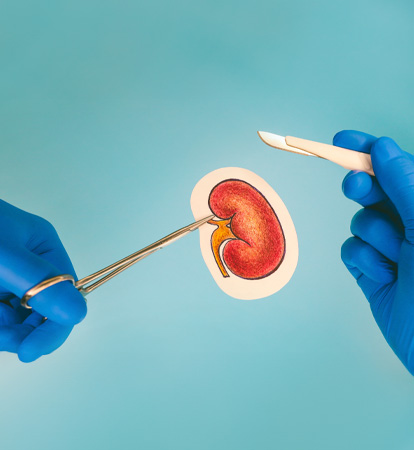 Preparing For Kidney Transplantation A Step-by-Step Guide For Patients In India