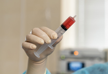 What to Expect and How to Prepare for Bone Marrow Transplant Treatment Options